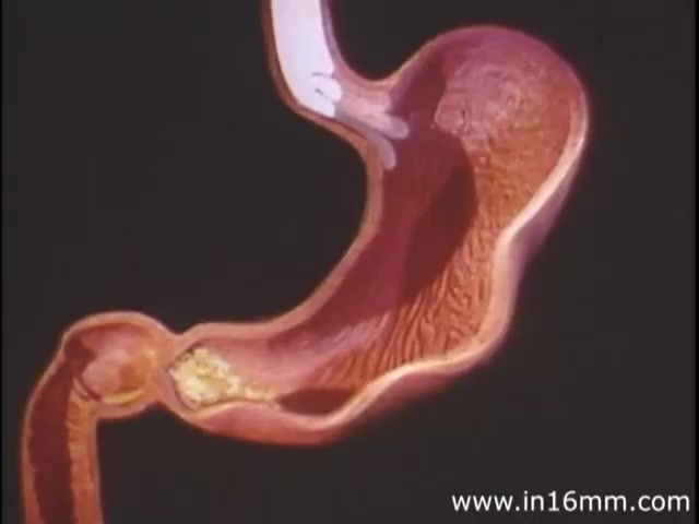 The still from 'I am Joe's Stomach' presents a colorful, three-dimensional animation of the human stomach. It features a detailed depiction of the stomach's interior, highlighting its texture and structure. The image likely aims to educate viewers on the stomach's functions and the digestive process, using creative visuals to illustrate how it operates, especially in relation to digestive issues. The overall tone is informative and aimed at conveying the importance of stomach health in a relatable manner.