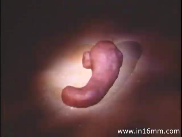 The still from 'I Am Joe's Stomach' showcases a three-dimensional animated representation of the human stomach, characterized by a pronounced, organic shape bathed in warm lighting. The animation effectively illustrates the stomach's form as a vital organ while emphasizing its functionality and importance in digestion. This educational piece combines animation with live-action sequences to highlight the experiences of a figurative character dealing with digestive issues, underscoring the significance of proper stomach care.