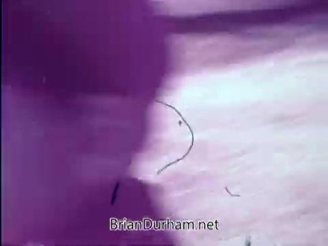 The 16mm still from the 'Prevent Blindness PSA - 1967' likely features a visual representation related to amblyopia, or 'lazy eye.' The voiceover emphasizes the importance of vision for children, highlighting that one in twenty preschoolers may have eye problems. It points out that untreated amblyopia can lead to permanent vision issues and underscores the necessity for early detection and intervention to prevent blindness. The imagery probably supports the critical message about eye health and awareness.