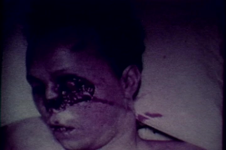 The still shows a deceased individual with visible facial injuries, likely intended to underscore the grim consequences of drug abuse. The image has a somber, muted color palette typical of 1970s anti-drug films, emphasizing the serious subject matter. This particular scene aims to evoke a strong emotional response, reinforcing the film's cautionary message against drug use.
