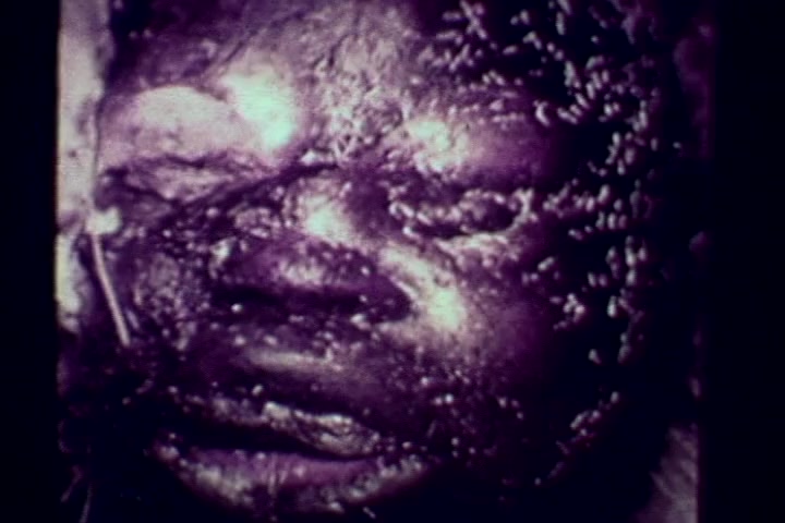 The still depicts a close-up of a deceased individual, showing a face marked by decay and insect activity. The image is stark and disturbing, typical of anti-drug messaging in the 1970s, highlighting the severe consequences of drug abuse. The visual serves to provoke a strong emotional response, warning viewers about the dangers associated with drug use.