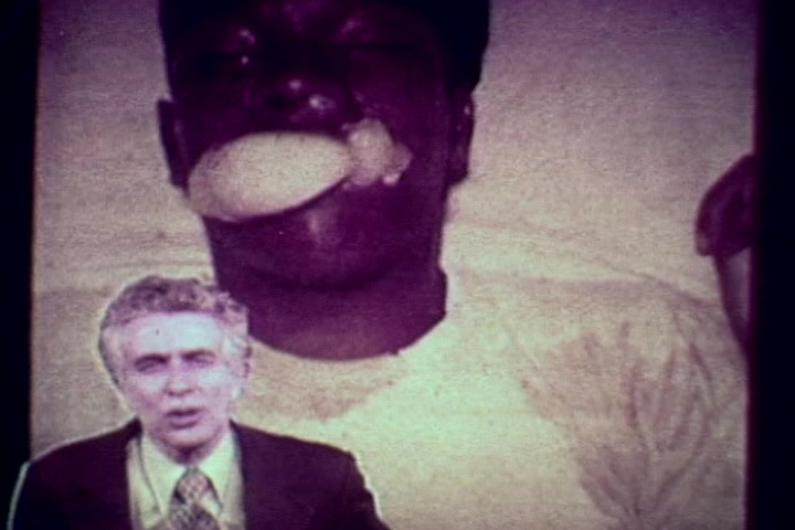 The still from 'Drug Abuse: Some Comments from the Morgue' features a grim scene with a deceased individual, who appears to be in a state of distress, indicated by a substance in their mouth. In the foreground, Tillman Hahn, likely delivering commentary, is shown with a serious expression. The visual style, typical of 1970s anti-drug films, employs stark imagery to highlight the consequences of drug abuse. The overall tone is sobering, aimed at raising awareness about the dangers of drugs.
