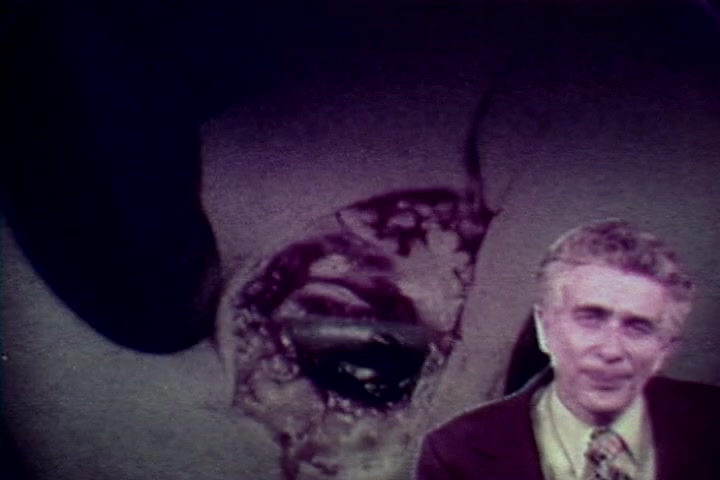 The still from 'Drug Abuse: Some comments from the morgue' features Tillman Hahn from the Medical Examiner's office, positioned against a graphic depiction of drug-related harm. The image starkly contrasts Hahn's formal attire with the disturbing visuals, emphasizing the film's anti-drug message. The setting evokes a somber and educational tone, underscoring the serious consequences of drug abuse.
