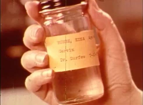 The still features a close-up of a hand holding a glass jar with a screw-top lid. The jar contains a clear liquid and has a yellow label that reads 'Tissue, human leg Seawix' along with the name 'Dr. Durfee' and a date. The film appears to be part of an educational segment discussing human cells and cytology, emphasizing the practical aspects of biological study. The overall image is characterized by a vintage aesthetic typical of 16mm prints.