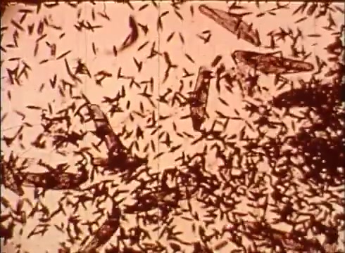 The still from 'The Human Cell and the Cytologist' features a close-up view of a dense field of microscopic organisms or cellular structures. The image is composed of numerous elongated and thin shapes that appear to be moving or floating, likely representing various cells or microorganisms. The overall tone is muted and sepia-like, characteristic of vintage 16mm film, emphasizing the educational aspect of cytology in the context of biological study.