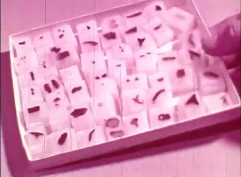 The still depicts a collection of small, rectangular sample slides arranged in a box. Each slide contains various cellular structures, which are likely stained to enhance visibility. The overall aesthetic is pinkish, characteristic of older film prints. The scene emphasizes the study of human cells, aiming to educate viewers about cytology and the microscopic examination of these samples.