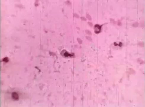 The still features a microscopic view of human cells, characterized by a pinkish background with various cellular structures visible. Some cells appear round and distinct, while others are smaller and more irregular, reflecting the complexity of biological material. The film captures intricate details typically studied in cytology, highlighting the educational focus on human cellular biology.
